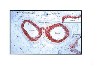 Dr Dinah Parums. The Localisation of PDE-5 to smooth muscle cells but not endothelium in coronary arteries.
