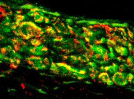 Dr Dinah Parums | Publications